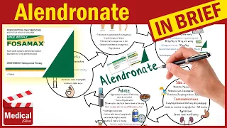 Alendronate Sodium 70 mg (Fosamax): What is Alendronate used for? Fosamax Uses, Dosage, Side Effects