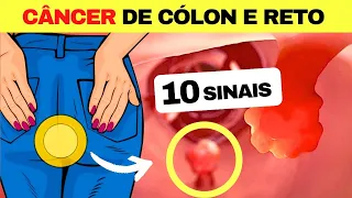 10 SINAIS de Alerta para CÂNCER de CÓLON e RETO que Todos Deveriam Saber