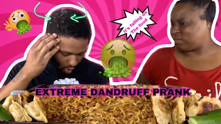 EXTREME DANDRUFF MUKPRANK & CHEESY SPICY BLACKBEAN NOODLES MUKBANG!