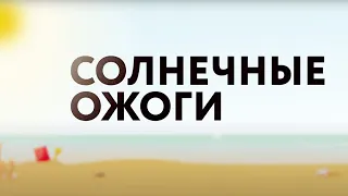 Солнечные ожоги // «Это должен знать каждый»