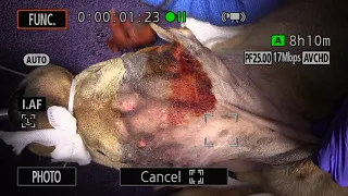 Live stream - bilateral total ear canal ablation