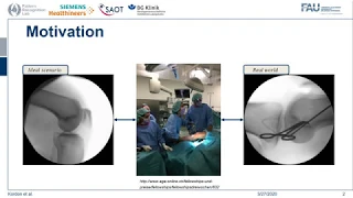 Font Augmentation - Implant and Surgical Tool Simulation for X-Ray Image Processing