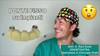 PONTE FISSO su impianti - com’è fatto?