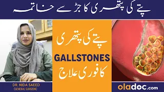 Pitay Me Pathri Ka Ilaj - Gallstones Symptoms And Treatment - Pitte Ki Pathri Ka Dard Kahan Hota Hai