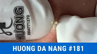 #181 | Huong Da Nang