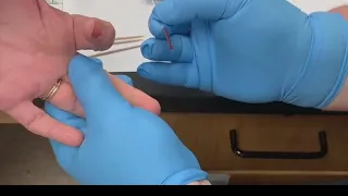 Blood Typing Demonstration