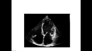 Cardiac anatomy for radiology - part 7 - other imaging modalities