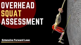 Overhead Squat Assessment |  Extensive Forward Lean