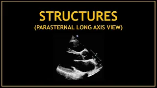 Cardiac STRUCTURES! - Echocardiography (parasternal long axis view)
