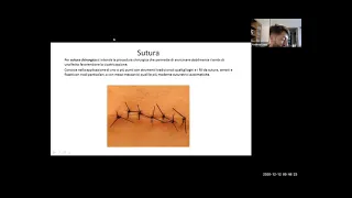 Sutura chirurgica, spiegazione - Webinar NG formazione