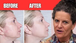 Life Changing Hacks To Clear Your Skin Stop Acne, Aging & Wrinkles | Dr. Mindy Pelz