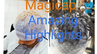 How to use the magicap | Amazing Highlights