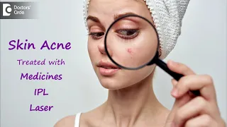 Treatment Modalities  for Skin Acne |  Get rid of ACNE SOON  - Dr. Rajdeep Mysore | Doctors' Circle