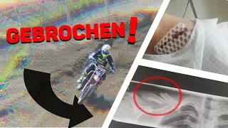 Italien MX-Training endet als Unfall! | MXvlog