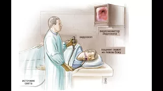 Полипоз желудка, лейомиома желудка