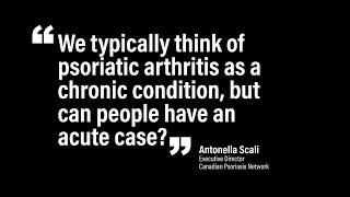 Can people have an acute case of psoriatic arthritis?