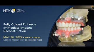 Fully Guided Full Arch Immediate Implant Reconstruction