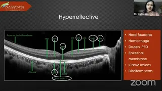 Webinar 3. How to read a Retina OCT. Dr.Chaitra Jayadev