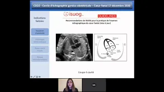 Indications de l'échographie cardiaque foetale et circuits de prise en charge