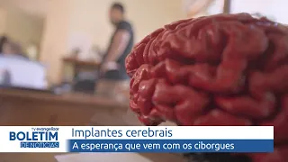 Implantes cerebrais: A esperança que vem com os ciborgues | Boletim de Notícias | 25/08/23