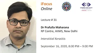 iFocus Online, Session 31