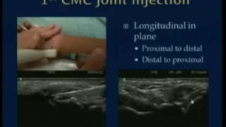 Ultrasound Guided Procedures