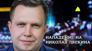 Срочно! Николай Ляскин подвергся нападению | [NEWS 15.09.2017] | Острый Угол