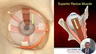 Kaye Family Learning Day 2023: Strabismus Surgery