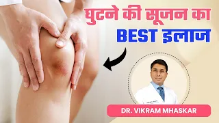 घुटने में सूजन (Knee Effusion) क्या होता है? | घुटने की सूजन का Best इलाज | Dr. Vikram Mhaskar