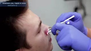 Искривление перегородки носа: комплексная диагностика и лечение
