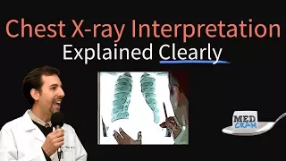 Chest X-Ray Interpretation Explained Clearly - How to read a CXR