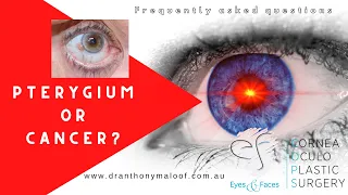 FAQ - Pterygium or cancer - Dr Anthony Maloof, Sydney