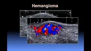 Ultrasound of the Hand and Wrist Ultrasound Video Lecture