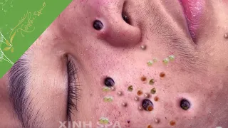 Satisfying videos for Relaxation with XINH SPA CHANNEL 5 #233