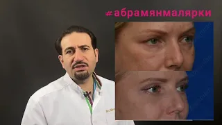 Малярные мешки или малряные жиры.