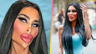 BOTCHED Plastic Surgery That Made Celebrities Unrecognizable | Marathon