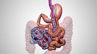 One Anastomosis Gastric Bypass Animation