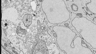 A novel animal model for studying the in vivo innate immune response to Toxoplasma infection