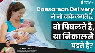 Stitches taken in Caesarean section needs to be Removed or not ? | Dr. Asha Gavade | Umang Hospital