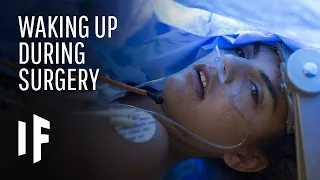 What Happens If You Wake up During Surgery?