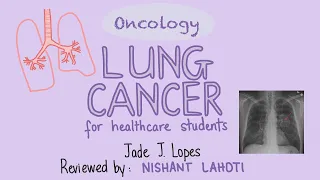 ONCOLOGY - Lung Cancer for Medical Students