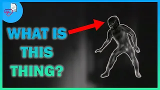 Sleep Paralysis: Why Do We See Shadow People?