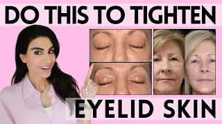 Eyelid Rejuvenation 101: Dermatologist Reveal Skin Tightening Treatments for the Eyes