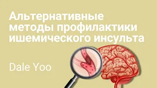 Ишемический инсульт (инфаркт головного мозга): причины, симптомы, лечение и профилактика