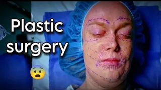 Plastic surgery से एक खुबसुरत औरत बनी 😳 || Hindi short movie explanation || The Listening.C