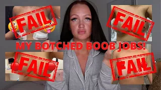 MY BOTCHED BOOB JOBS