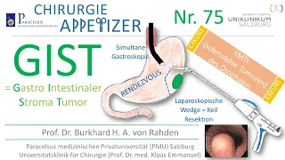 GIST Gastrointestinaler Stromatumor CHIRURGIE APPetizer Nr  75