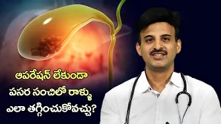 How To Remove Gallbladder Stone without Operation | Healthy Diet | Dr. Ravikanth Kongara