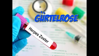 Herpes Zoster: Gürtelrose | Krankheitslehre | Pflege Kanal