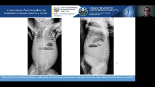 НАУЧНАЯ ШКОЛА «Рентгенография при аномалиях и пороках развития у детей»
